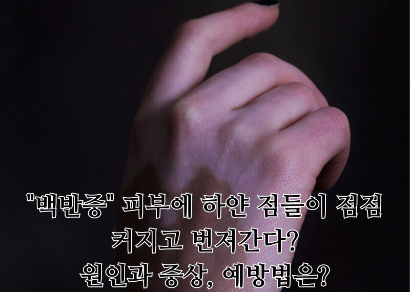 오늘은 언제 잠을 잘까 21 800x570